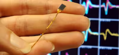 Implantes cerebrales para acabar con el estrés postraumático