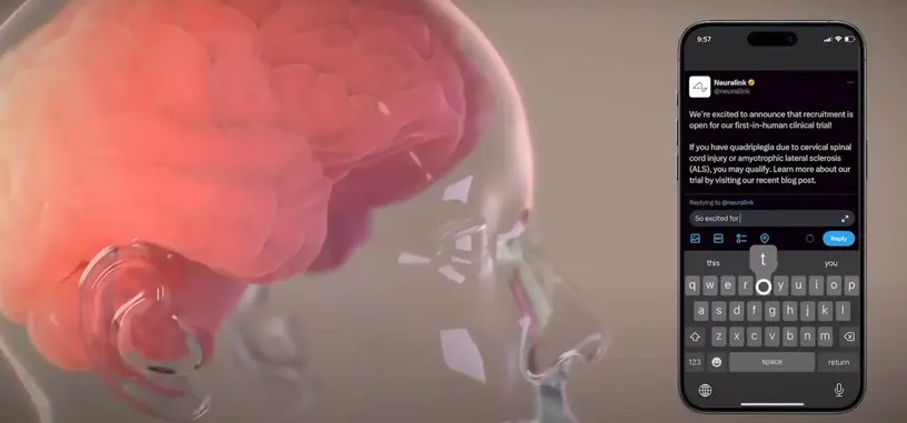 Neuralink muestra un vídeo de su primer paciente usando su implante