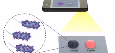 Solo se necesita una película biosensora y un teléfono para diagnosticar virus y bacterias