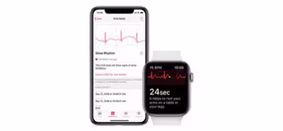 Apple activa el ECG del Watch serie 4 en España y otros países europeos