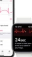 Apple activa el ECG del Watch serie 4 en España y otros países europeos